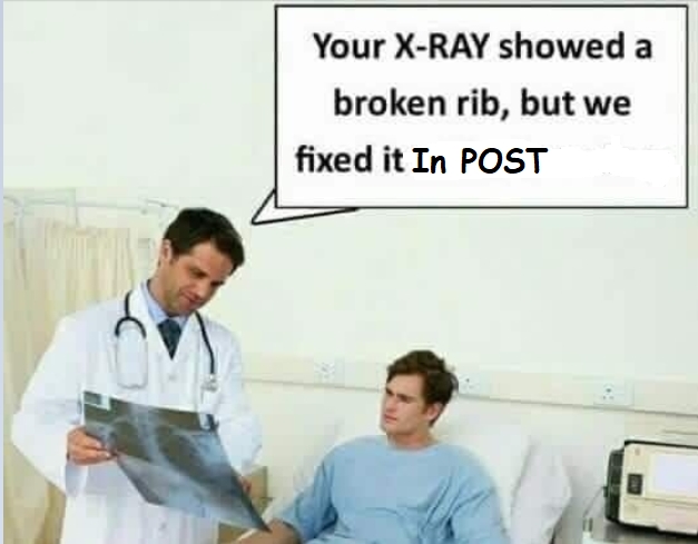 Doctor showing a patient an X-Ray of a broken rib in a humorous way telling him that they’ve fixed it in post-production